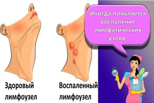 лимфоузлы