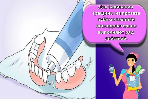 Для заливания трещины на протезе зубные техники последовательно выполняют ряд действий.